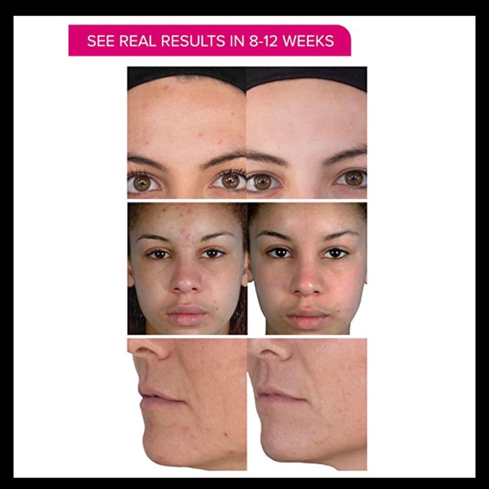 PMD Personal Microderm Skin Renewal System - Picture 5 of 8